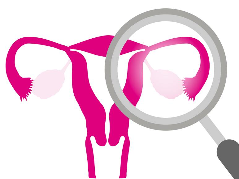 Fallopian Tube Exam Ok